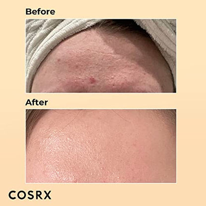 COSRX Skin Cycling Routine - Snail Mucin 96% Essence + Retinol 0.1 Cream, Recovery Set for Face and Neck, Fine Lines Spot Treatment, Repair Cream for Face